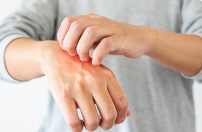 Allergy and Autoimmune therapy